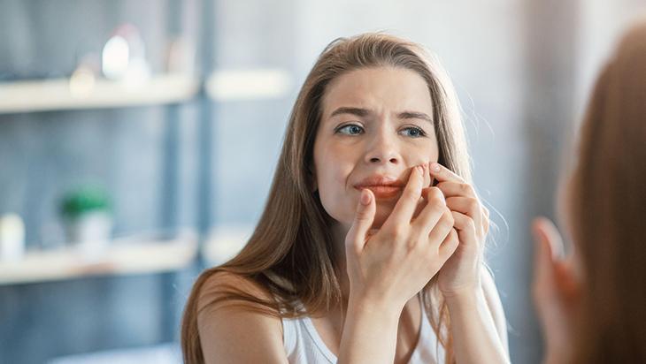 Akneyle mücadelede doğru adım! Erken tedavi iz bırakmıyor